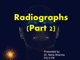 Radiographs
(Part 2)
Presented by
Dr. Neha Sharma
PG II YR
 