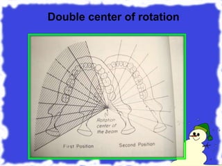 Double center of rotation
 