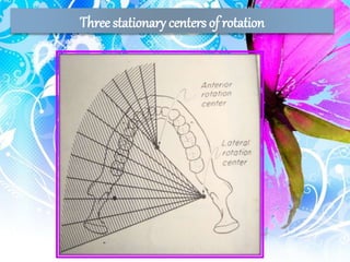 Three stationary centers of rotation
 