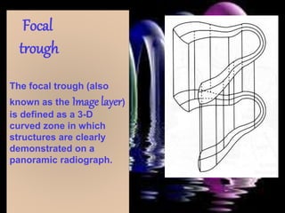 Focal
trough
The focal trough (also
known as the Image layer)
is defined as a 3-D
curved zone in which
structures are clearly
demonstrated on a
panoramic radiograph.
 