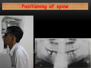 Positioning of spine
 