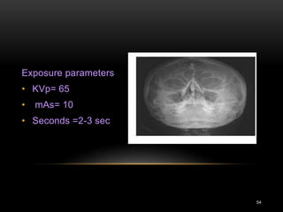54
Exposure parameters
• KVp= 65
• mAs= 10
• Seconds =2-3 sec
 