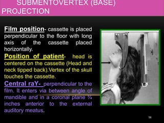 56
Film position- cassette is placed
perpendicular to the floor with long
axis of the cassette placed
horizontally.
Position of patient- head is
centered on the cassette (Head and
neck tipped back).Vertex of the skull
touches the cassette.
Central raY- perpendicular to the
film. It enters via between angle of
mandible and in a coronal plane ¾
inches anterior to the external
auditory meatus.
SUBMENTOVERTEX (BASE)
PROJECTION
 