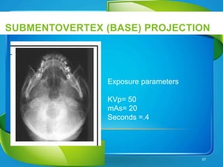 SUBMENTOVERTEX (BASE) PROJECTION
57
Exposure parameters
KVp= 50
mAs= 20
Seconds =.4
 