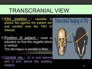 TRANSCRANIAL VIEW
63
Film position - cassette is
placed flat against the patient ear
and centred over the TMJ of
interest.
Position of patient - head is
adjusted so that the saggital plane
is vertical.
The ala tragus is parallel to floor.
Central ray - is ½ inch behind
and 2 inch above the auditory
meatus
 