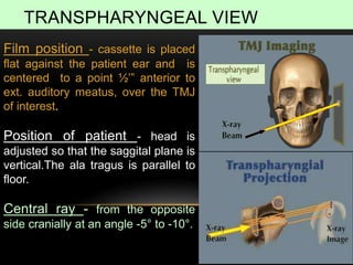 TRANSPHARYNGEAL VIEW
65
Film position - cassette is placed
flat against the patient ear and is
centered to a point ½’” anterior to
ext. auditory meatus, over the TMJ
of interest.
Position of patient - head is
adjusted so that the saggital plane is
vertical.The ala tragus is parallel to
floor.
Central ray - from the opposite
side cranially at an angle -5° to -10°.
 