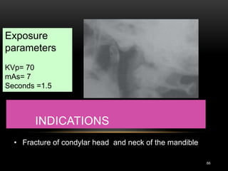 INDICATIONS
66
• Fracture of condylar head and neck of the mandible
Exposure
parameters
KVp= 70
mAs= 7
Seconds =1.5
 