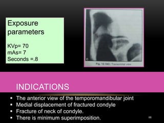 INDICATIONS
68
 The anterior view of the temporomandibular joint
 Medial displacement of fractured condyle
 Fracture of neck of condyle.
 There is minimum superimposition.
Exposure
parameters
KVp= 70
mAs= 7
Seconds =.8
 