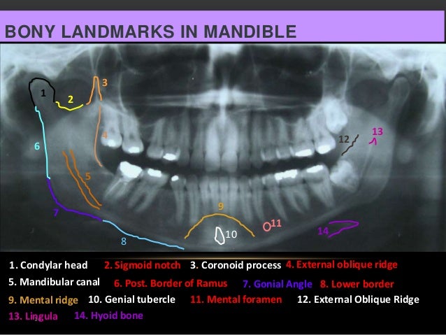 OPG and Extraoral radiography