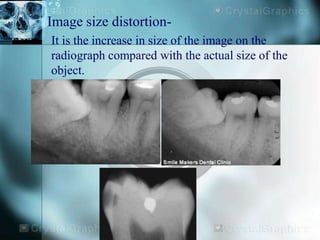 Size Distortion Radiograph Radiograph sem | PPTX