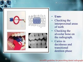 Radiograph sem | PPTX