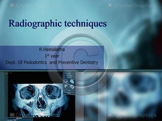 Radiographic techniques
R.Hemalatha
1st year
Dept. Of Pedodontcs and Preventive Dentistry

 