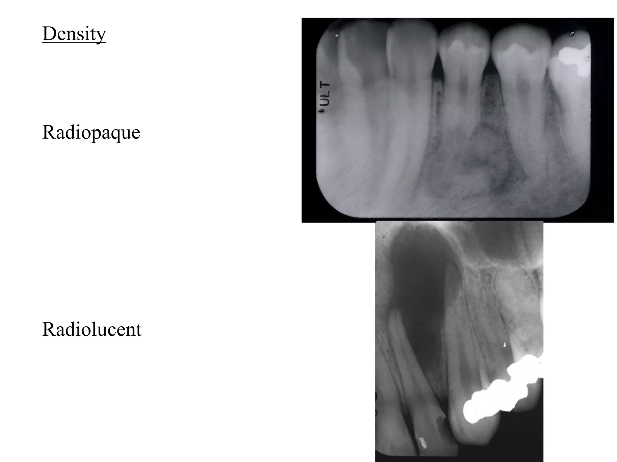 Radiographs in endodontics | PDF