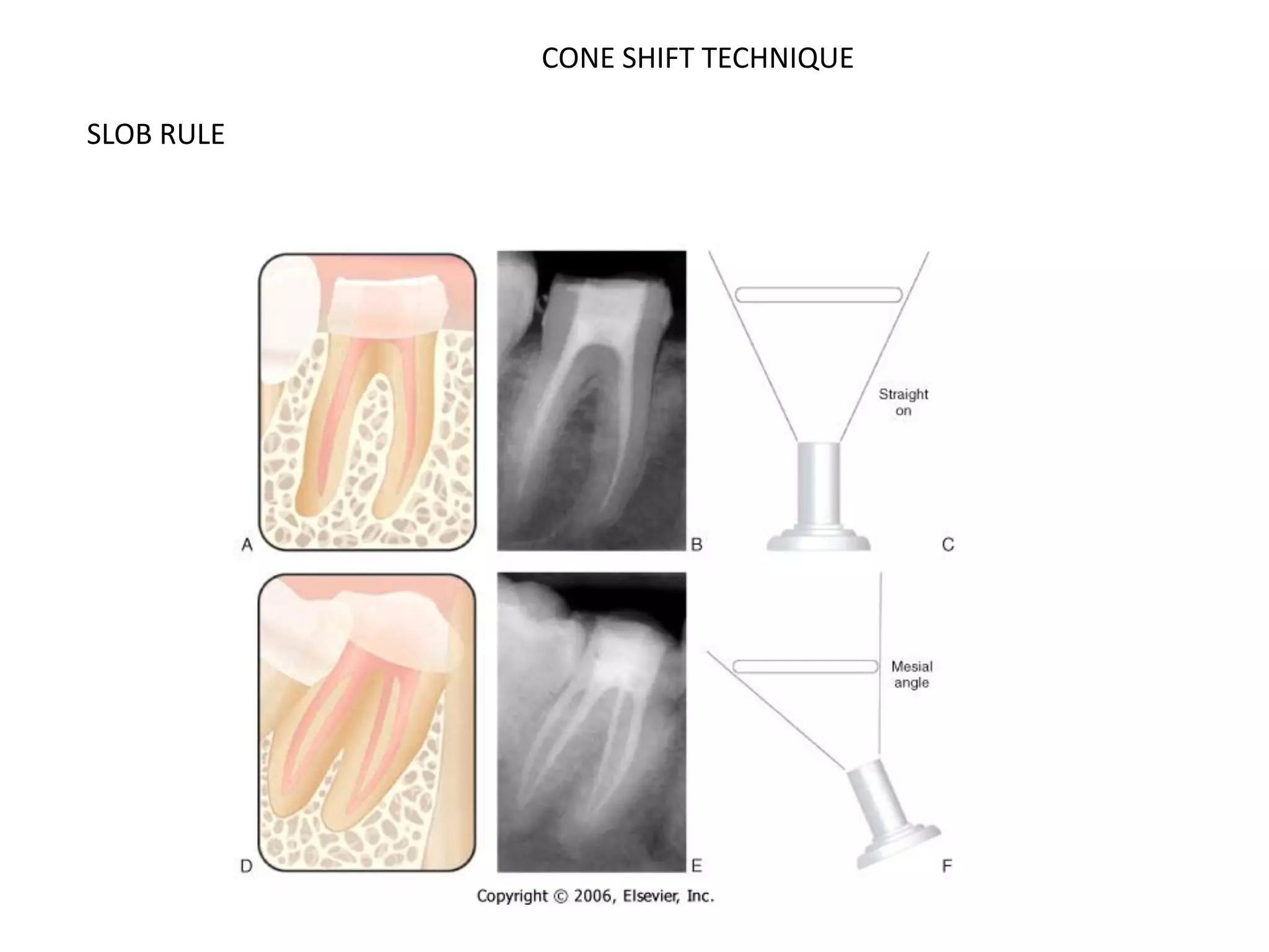 Radiographs in endodontics | PDF