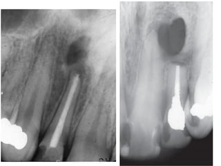 Visualization Endogram Radiographs in endodontics | PDF