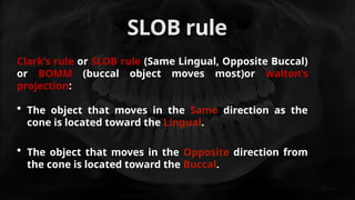 Using Slob Rule Radiograph radiographs used in endo part 1 ppt.pptx