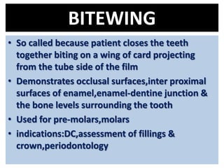 Projecting Tooth Radiography | PPTX