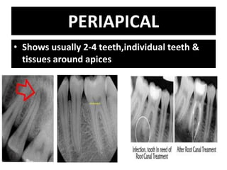 Radiography | PPTX