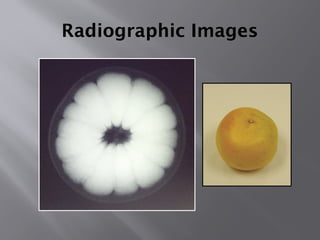 Technical seminar on Introduction to RADIOGRAPHY.pptx