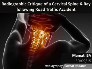 Radiographic Critique of a Cervical Spine X-Ray
following Road Traffic Accident
Mamati BA
30/09/15
Radiography Clinical Updates
 