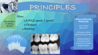 Films:
1.IOPA{E speed, F speed}
2.Occlusal
3.Bitewing
Film Holders
& Aiming
devices
Merits of Bitewing
Radiograph
1.Less Image
distortion.
2.Provides critical
information of crown.
3.Relationship of
remaining tooth
structure to crestal
height of bone
 