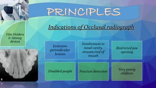 Indications of Occlusal radiographIndications of Occlusal radiograph
Film Holders
& Aiming
devices
 
