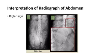 Comprehensive Radiography of Abdomen: Techniques, Anatomy, and ...