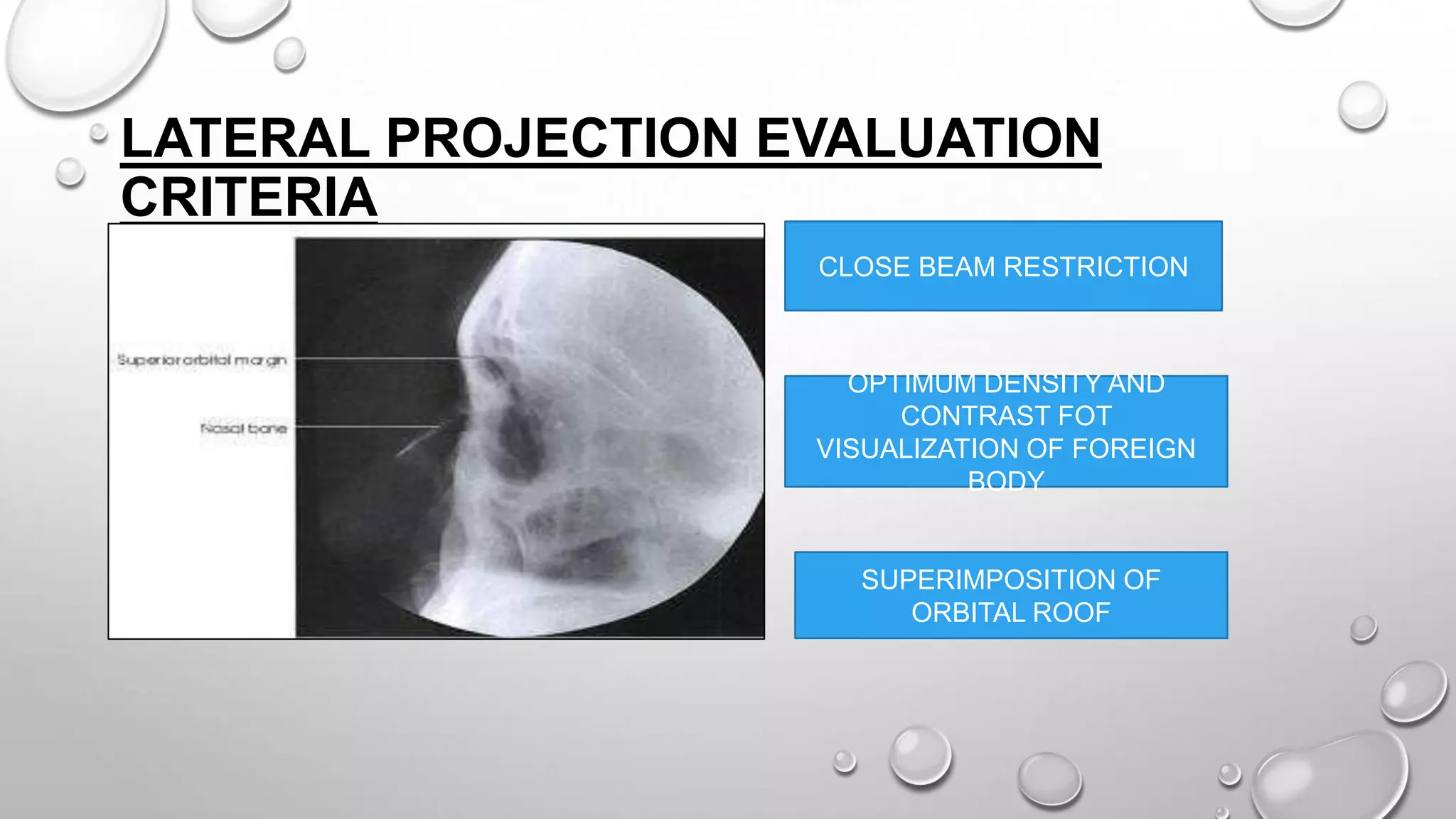 LATERAL PROJECTION EVALUATION
CRITERIA
CLOSE BEAM RESTRICTION
SUPERIMPOSITION OF
ORBITAL ROOF
OPTIMUM DENSITY AND
CONTRAST FOT
VISUALIZATION OF FOREIGN
BODY
 
