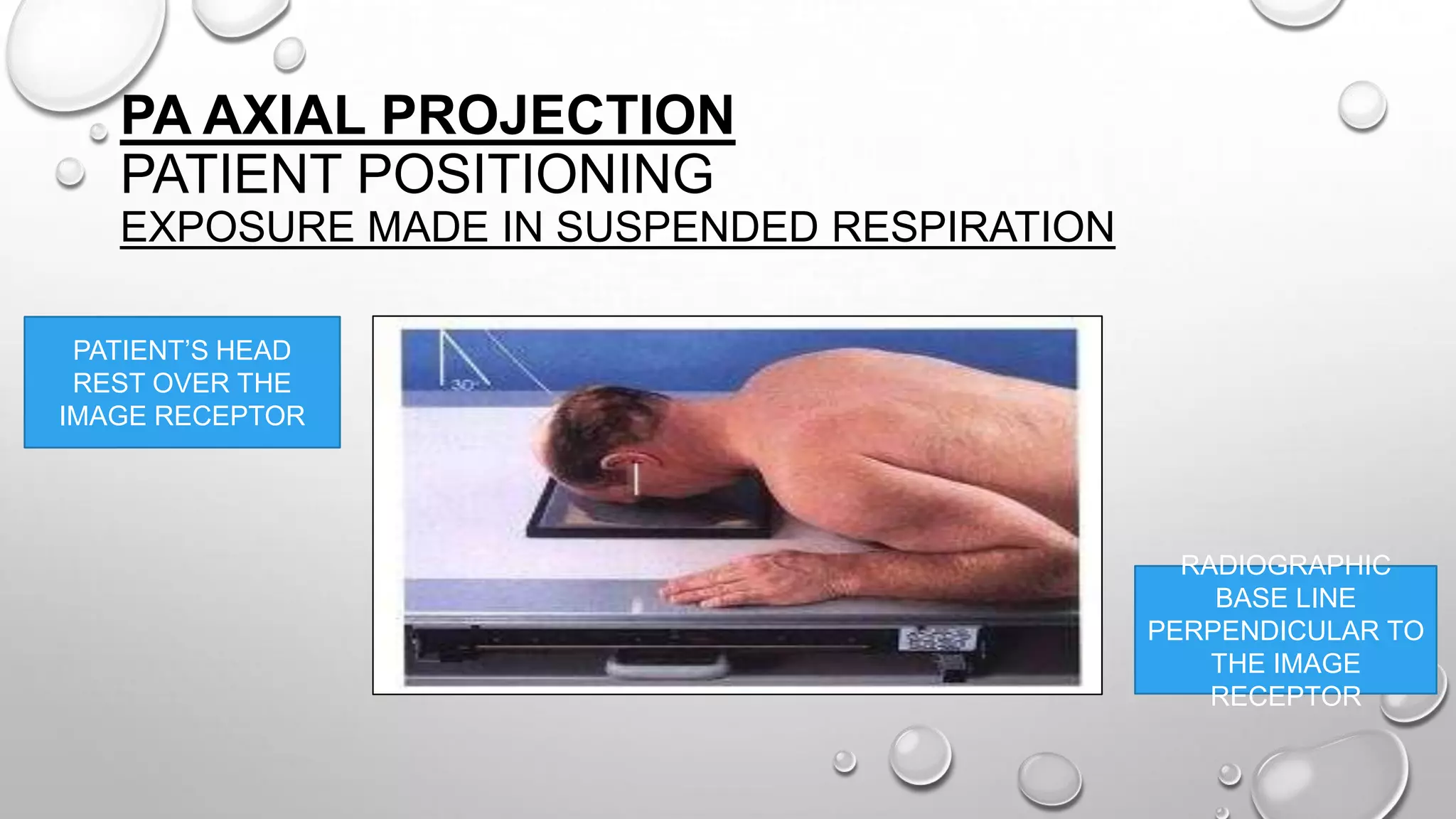 PA AXIAL PROJECTION
PATIENT POSITIONING
EXPOSURE MADE IN SUSPENDED RESPIRATION
PATIENT’S HEAD
REST OVER THE
IMAGE RECEPTOR
RADIOGRAPHIC
BASE LINE
PERPENDICULAR TO
THE IMAGE
RECEPTOR
 