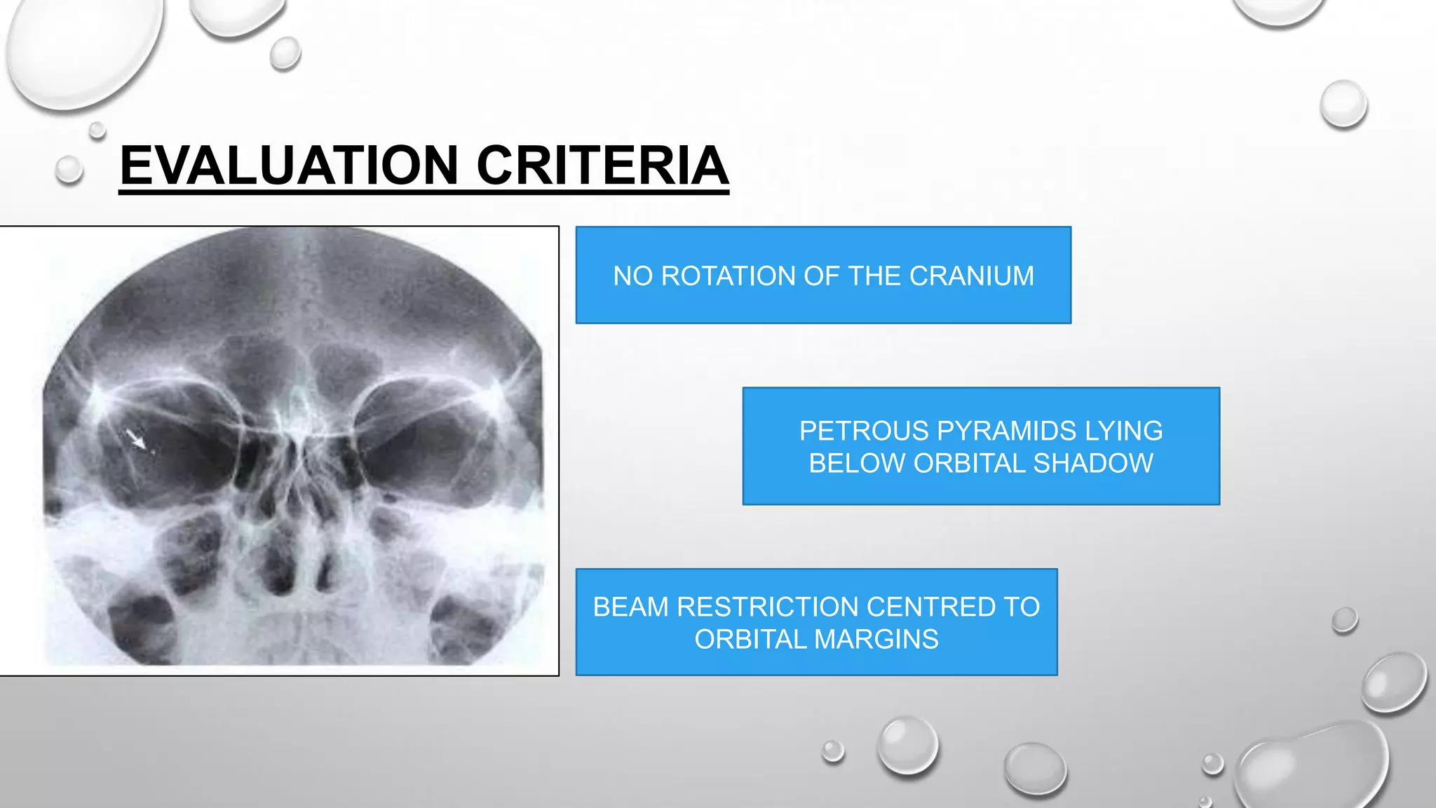 EVALUATION CRITERIA
NO ROTATION OF THE CRANIUM
PETROUS PYRAMIDS LYING
BELOW ORBITAL SHADOW
BEAM RESTRICTION CENTRED TO
ORBITAL MARGINS
 