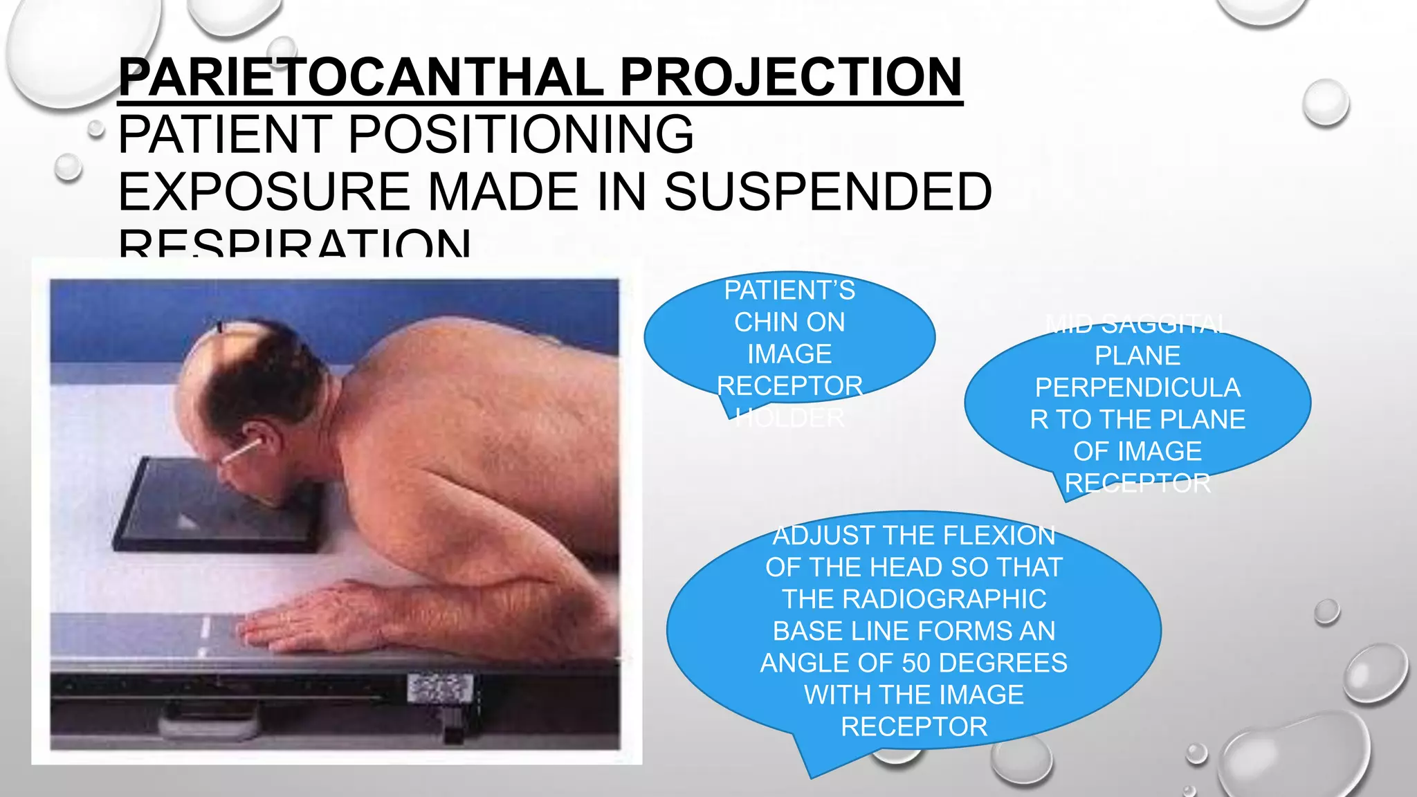 PARIETOCANTHAL PROJECTION
PATIENT POSITIONING
EXPOSURE MADE IN SUSPENDED
RESPIRATION REST
PATIENT’S
CHIN ON
IMAGE
RECEPTOR
HOLDER
MID SAGGITAL
PLANE
PERPENDICULA
R TO THE PLANE
OF IMAGE
RECEPTOR
ADJUST THE FLEXION
OF THE HEAD SO THAT
THE RADIOGRAPHIC
BASE LINE FORMS AN
ANGLE OF 50 DEGREES
WITH THE IMAGE
RECEPTOR
 