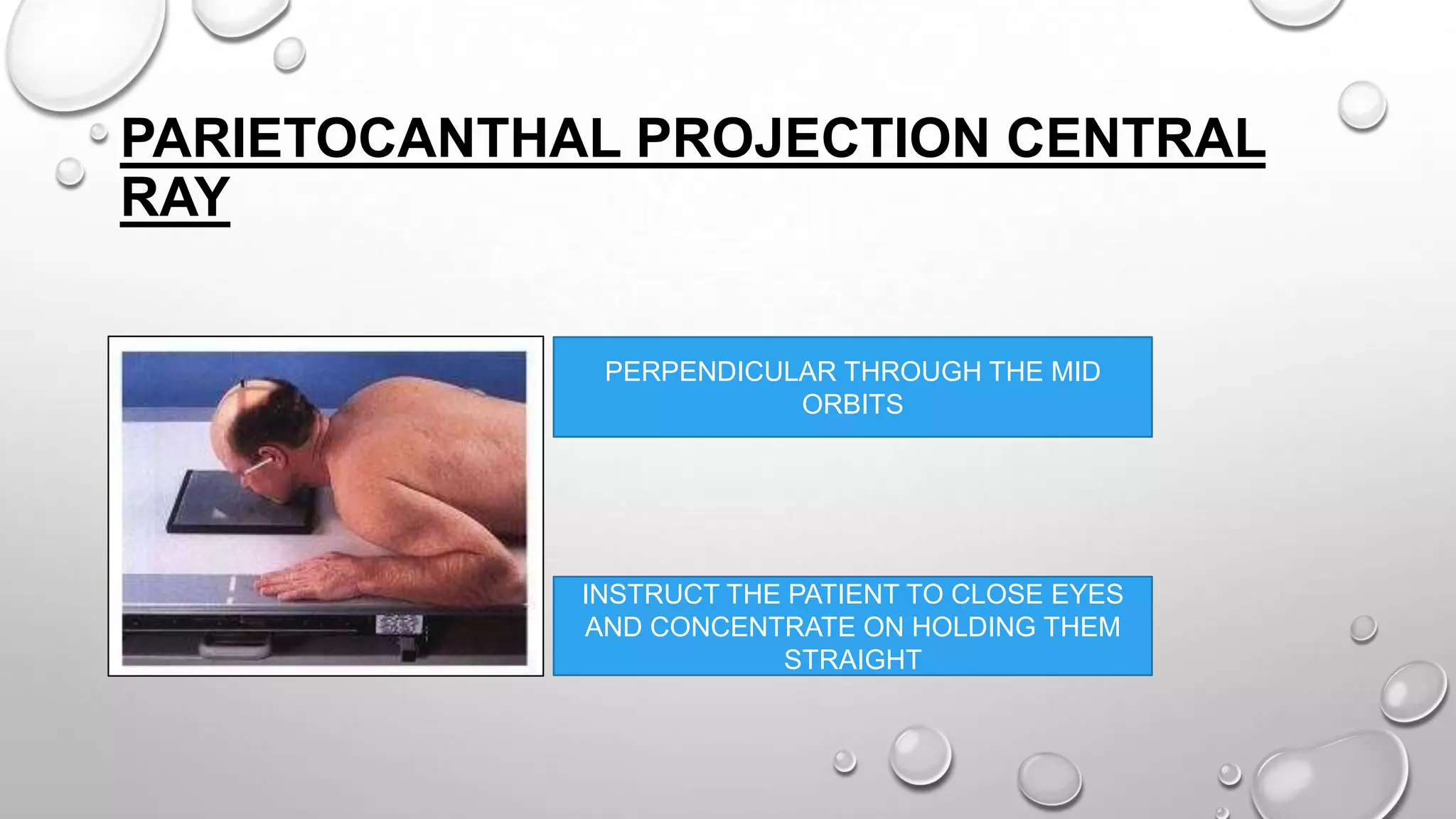 PARIETOCANTHAL PROJECTION CENTRAL
RAY
PERPENDICULAR THROUGH THE MID
ORBITS
INSTRUCT THE PATIENT TO CLOSE EYES
AND CONCENTRATE ON HOLDING THEM
STRAIGHT
 