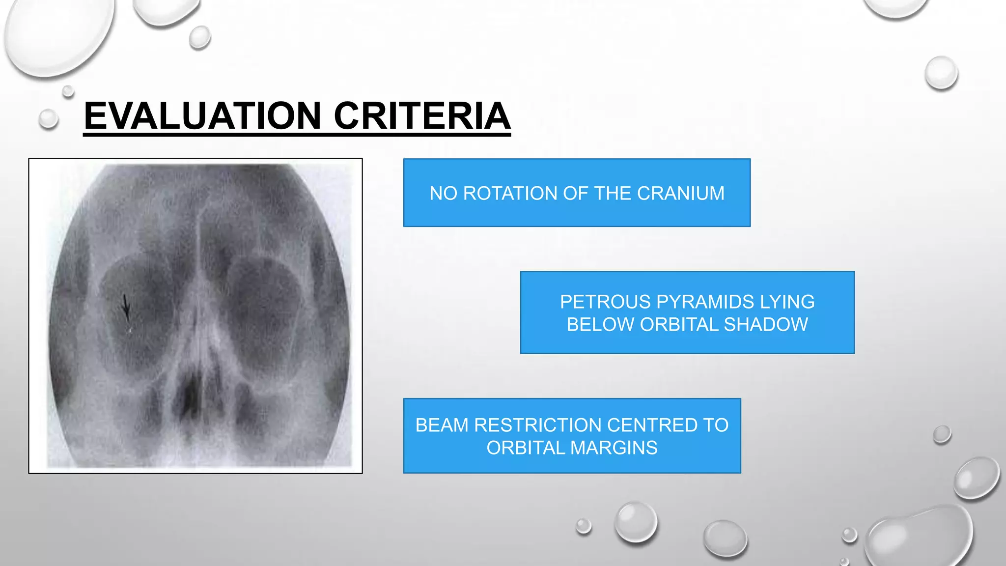 EVALUATION CRITERIA
NO ROTATION OF THE CRANIUM
PETROUS PYRAMIDS LYING
BELOW ORBITAL SHADOW
BEAM RESTRICTION CENTRED TO
ORBITAL MARGINS
 