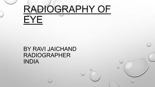 RADIOGRAPHY OF
EYE
BY RAVI JAICHAND
RADIOGRAPHER
INDIA
 