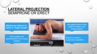 Radiography of eye | PPTX