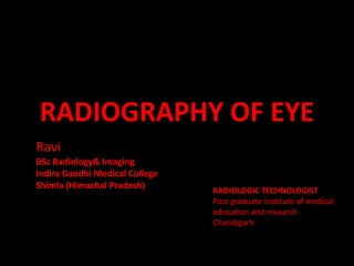 RADIOGRAPHY OF EYE
Ravi
RADIOLOGIC TECHNOLOGIST
Post graduate institute of medical
education and research
Chandigarh
BSc Radiology& Imaging
Indira Gandhi Medical College
Shimla (Himachal Pradesh)
 