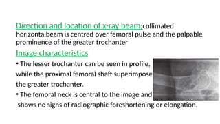 RADIOGRAPHY OF PELVIS AND HIPJOINTS.pptx