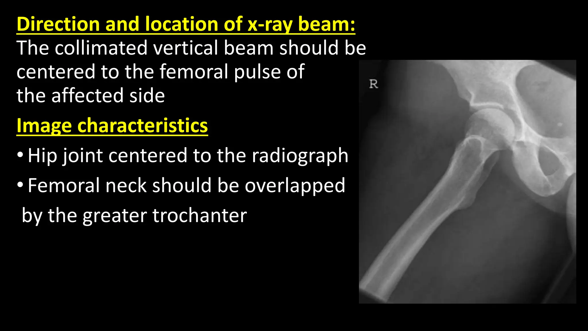 Vertical Radiograph Radiography of Pelvis & Hip Joints - Saroj.pptx