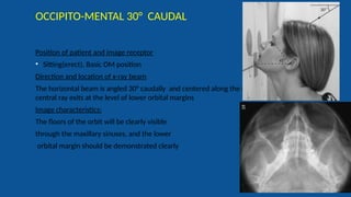 Radiography of skull [Autosaved].pptxriuyowioehgg | PPTX