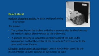 Radiography of skull [Autosaved].pptxriuyowioehgg | PPTX