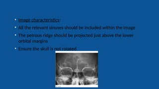 Radiography of skull [Autosaved].pptxriuyowioehgg | PPTX