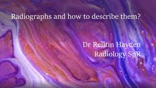 Radiographs and how to describe them?
Dr Reiltin Hayden
Radiology SpR
 
