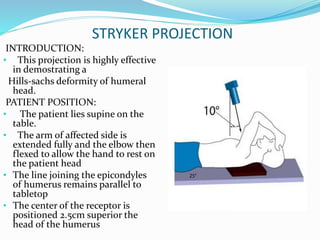Radiograpic views for shoulder joint | PPTX