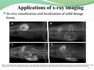 Applications of x-ray imaging
In-vivo visualization and localization of solid dosage
forms.
22
 