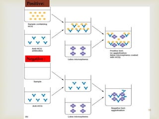 Negative :
Positive:
33
 