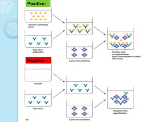 Negative :
Positive:
 