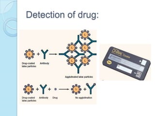 Detection of drug:
 