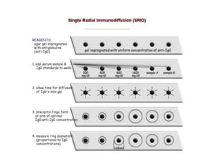 Radioimmunoassay