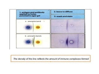 Radioimmunoassay