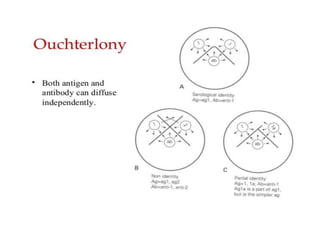 Radioimmunoassay